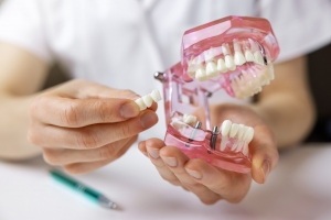 Restore your bite and appearance with dental bridges
